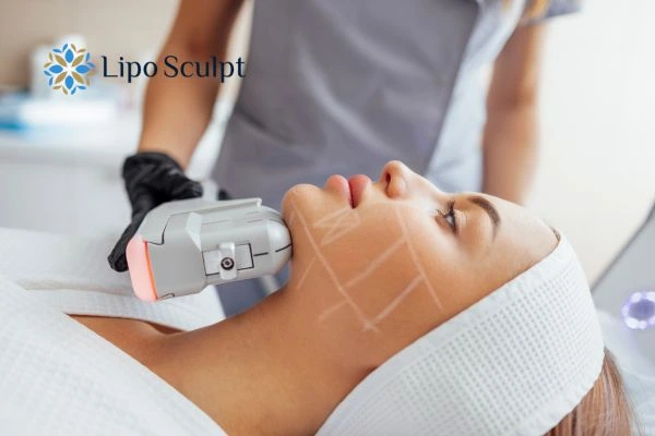 HIFU vs Botulinum Toxin: Understanding the Differences 1 HIFU vs Botox Gravesend What is the best option for you?