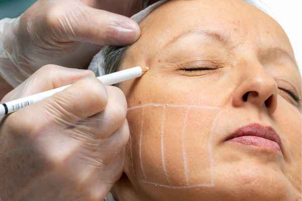 CryoPen: 5 Skin Concerns It May Be Used to Treat 4 What should you ask before having CryoPen treatment Gravesend?
