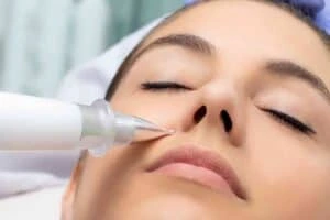 Best Actinic Keratoses Removal 3 Actinic keratoses Gravesend solutions - book in today!